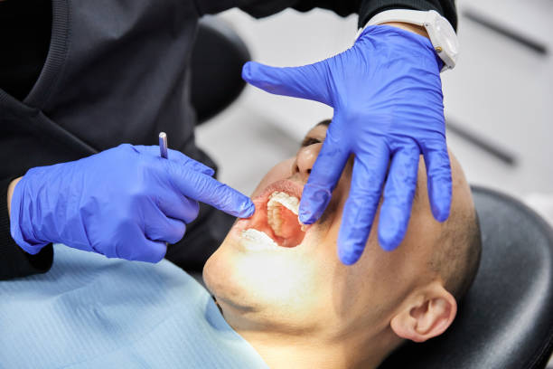 Best Emergency Wisdom Teeth Removal in Celina, TN