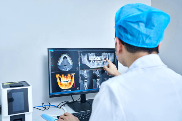 Best Emergency Wisdom Teeth Removal in Celina, TN
