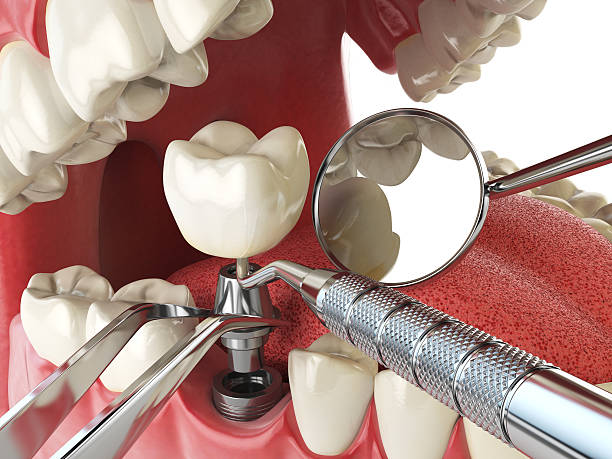 Best After-Hours Emergency Dentist in Celina, TN